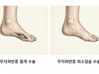 서울건우정형외과