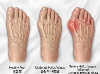 서울건우정형외과