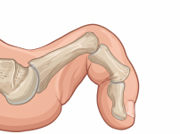 서울건우정형외과